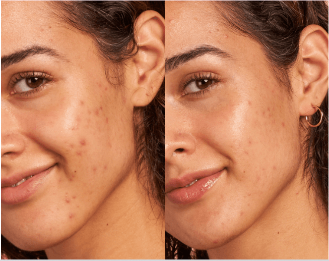Glow Recipe - Strawberry Smooth BHA + AHA Salicylic Serum (30mL)