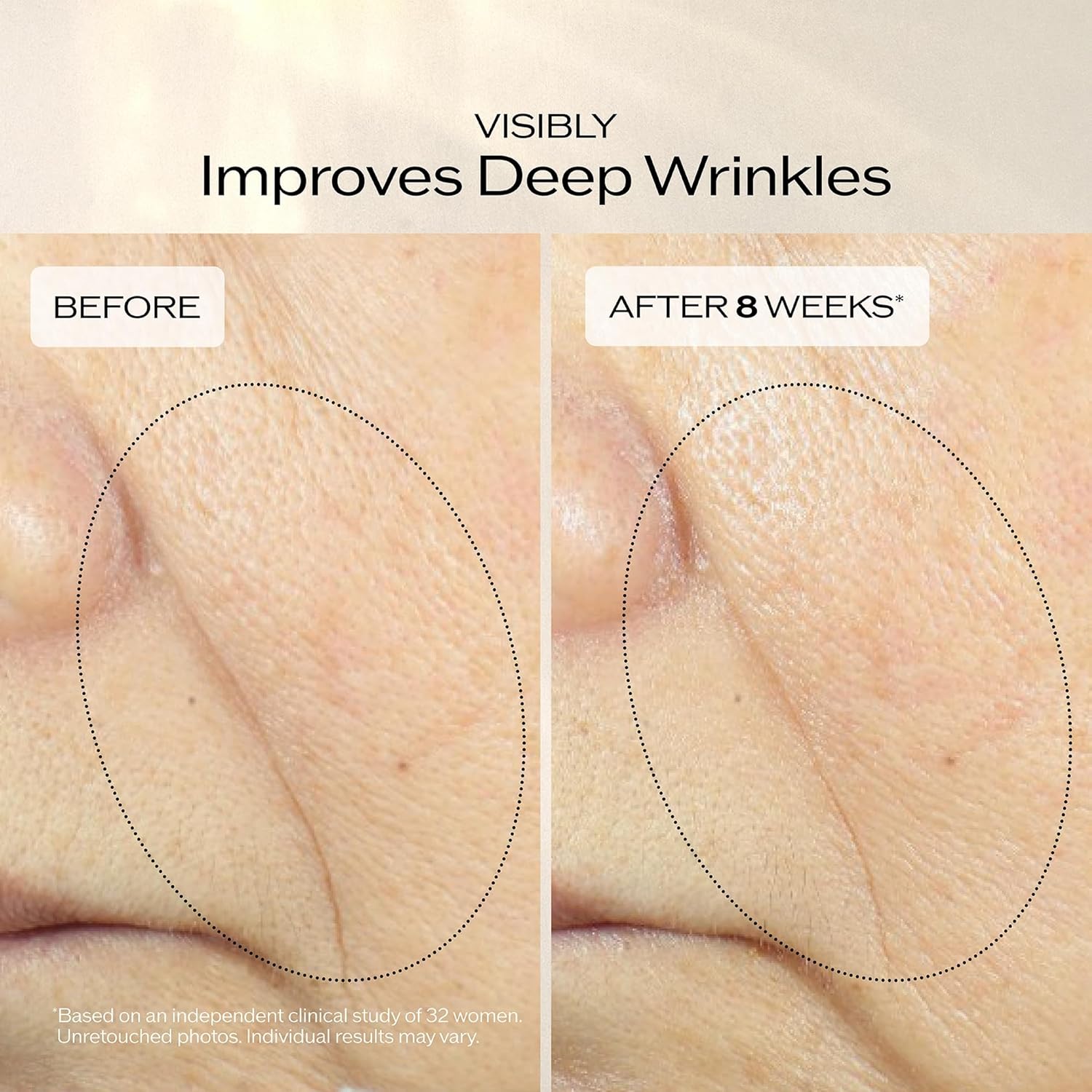 Shiseido Vital Perfection Uplifting and Firming Advanced Cream - 50 mL - Multi-Benefit Face Cream - Visibly Lifts & Firms